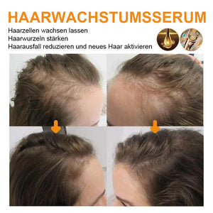 Ingwer-Haarwuchsserum