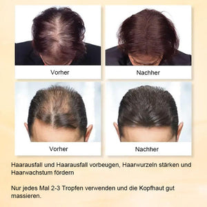 Ingwer-Haarwuchsserum